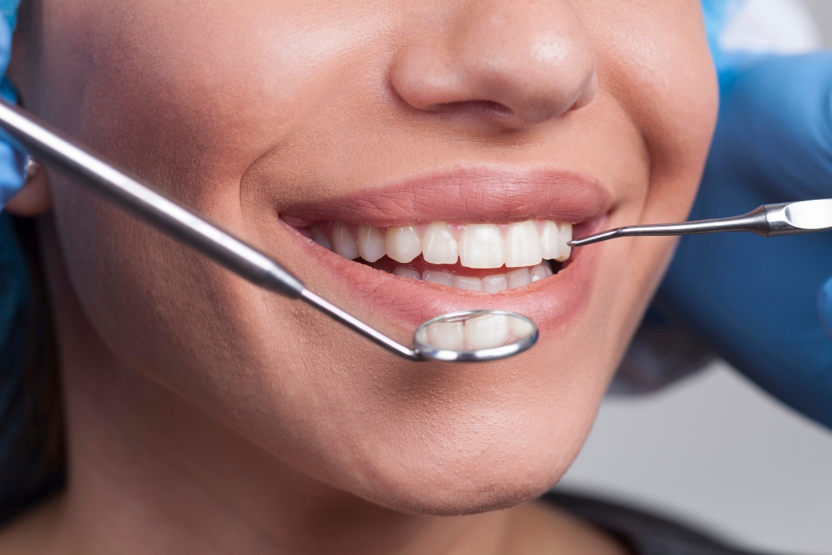 teeth-whitening-in-Culver-City